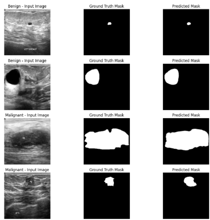 Edge-Deployable Deep Segmentation of Breast Ultrasound Images via Optimized U-Net
